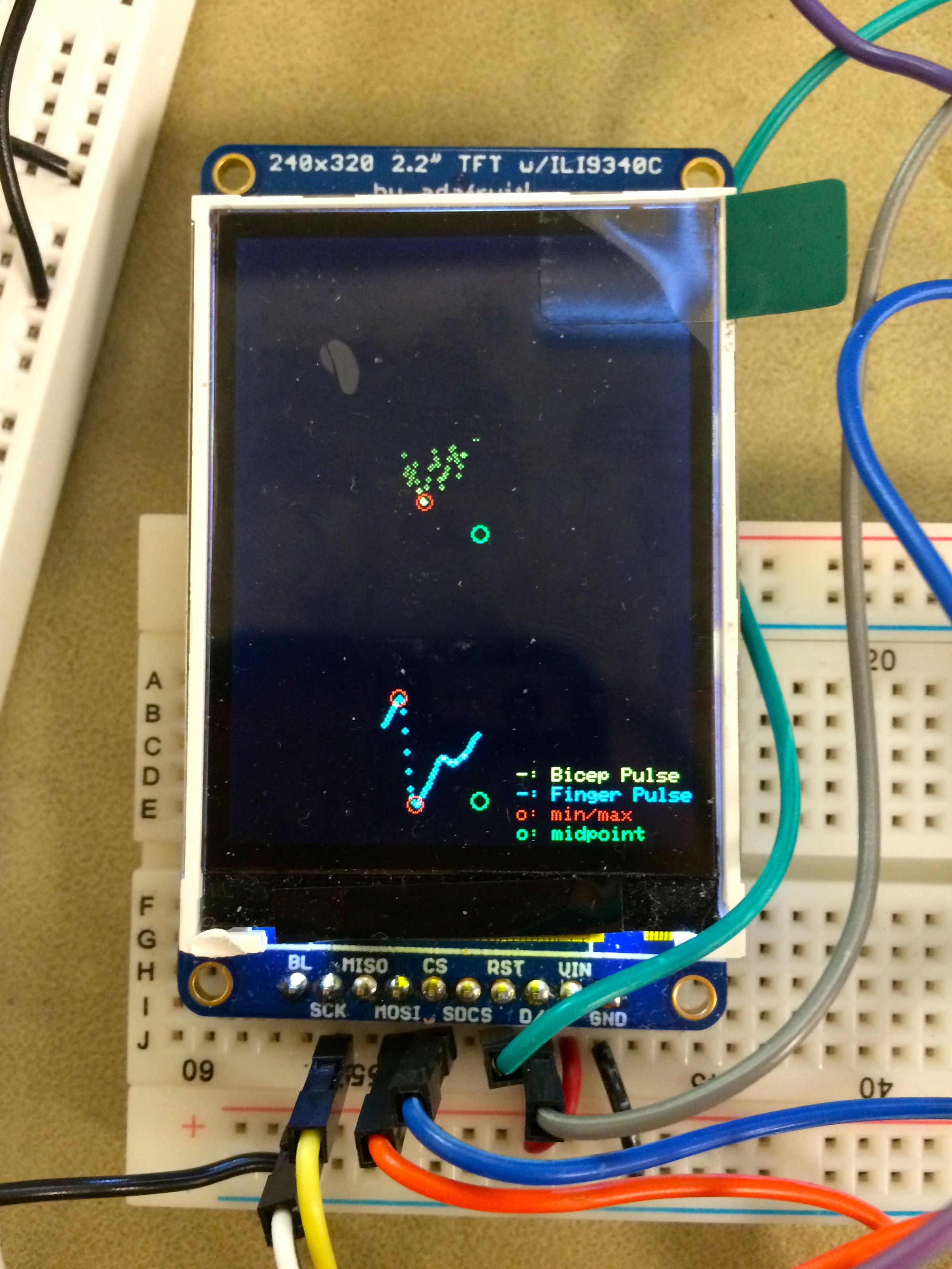 TFT Display with discarded midpoints