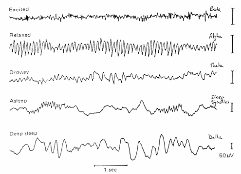 read microwave superconducting accelerators and